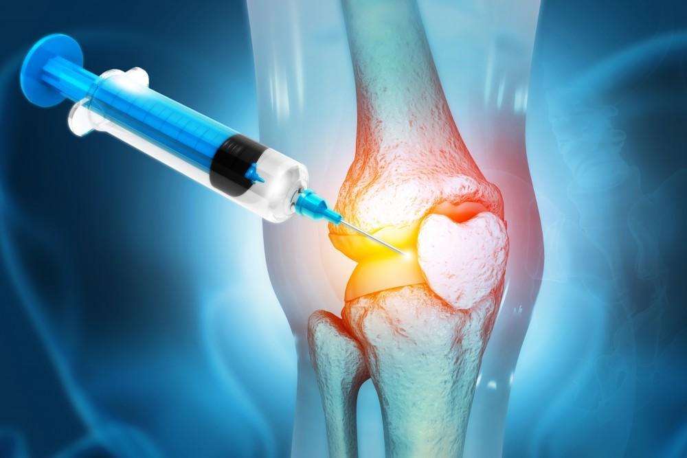platelet rich plasma for pain Fairhope Alabama